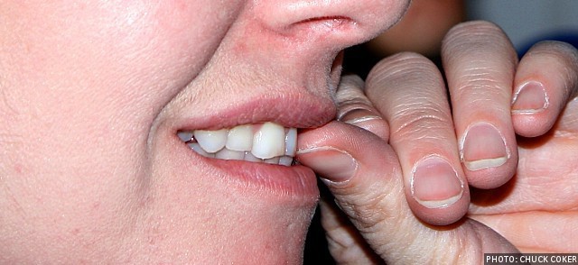 nail-biting-teeth-da9e105efba4a12d0923fc20fa4e5e61.jpg