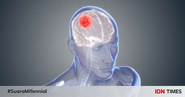 Glioblastoma Penyebab Gejala Jenis Diagnosis Pengobatan