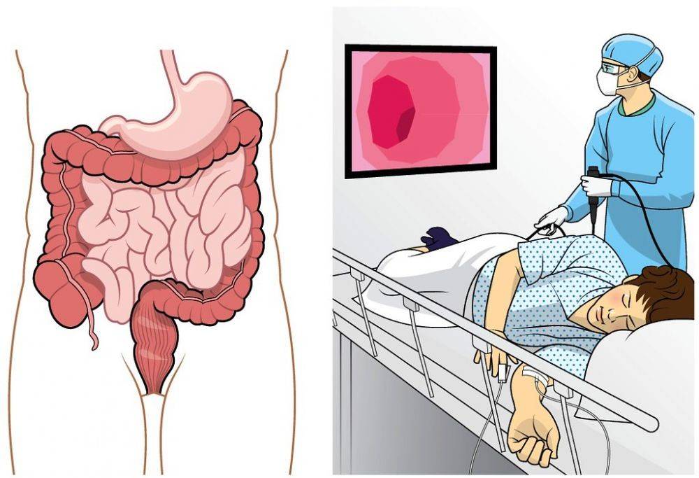 Beijing anus and intestine hospital