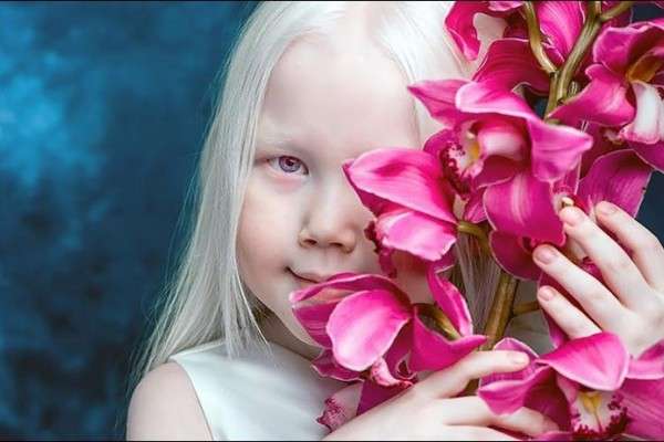 Dijuluki Snow White Dari Siberia Gadis Albino Ini Menjadi Rebutan Fotografer Dunia