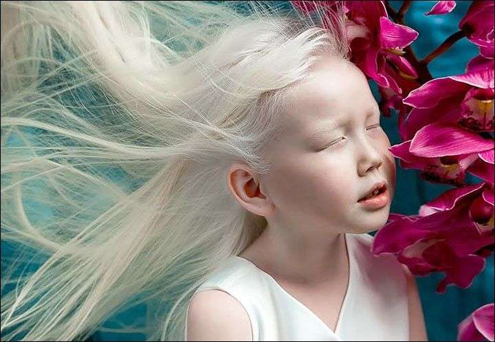 Dijuluki Snow White Dari Siberia Gadis Albino Ini Menjadi Rebutan Fotografer Dunia