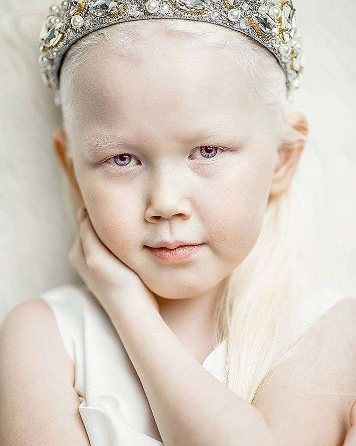 Dijuluki Snow White Dari Siberia Gadis Albino Ini Menjadi Rebutan Fotografer Dunia