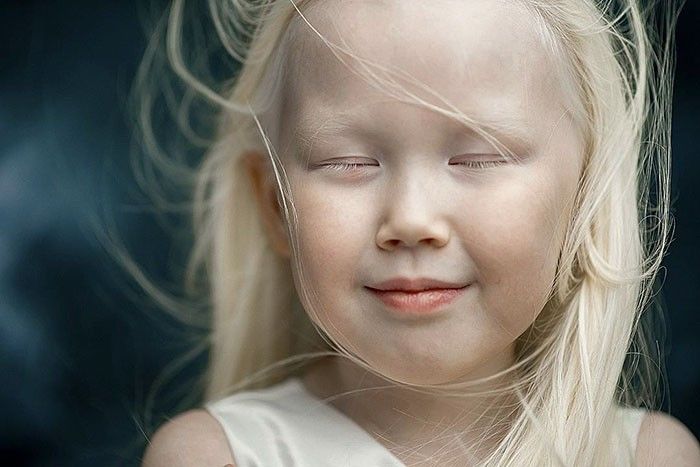 Dijuluki Snow White Dari Siberia Gadis Albino Ini Menjadi Rebutan Fotografer Dunia