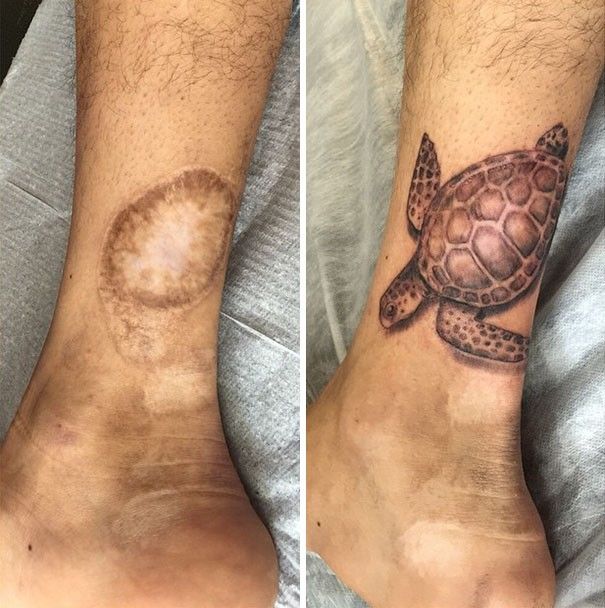 Kreatif Banget 30 Tato Ini Menyulap Bekas Luka Jadi Seni Indah