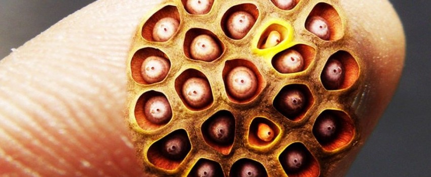 Kamu Trypophobia? Buktikan dengan Melihat Gambar-gambar Ini