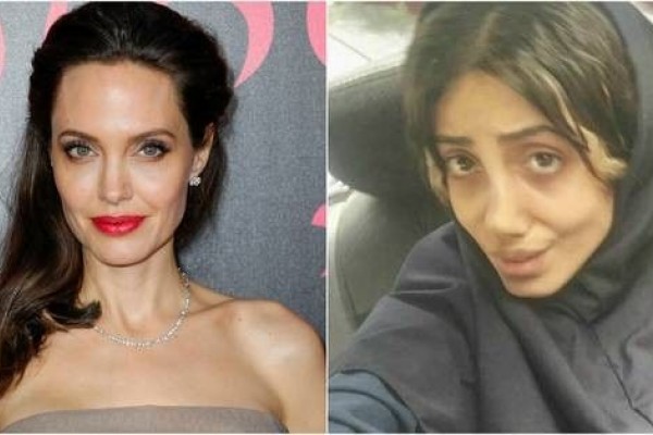 Obsesi Mirip Angelina Jolie Cewek Ini Operasi Plastik Hingga 50 Kali