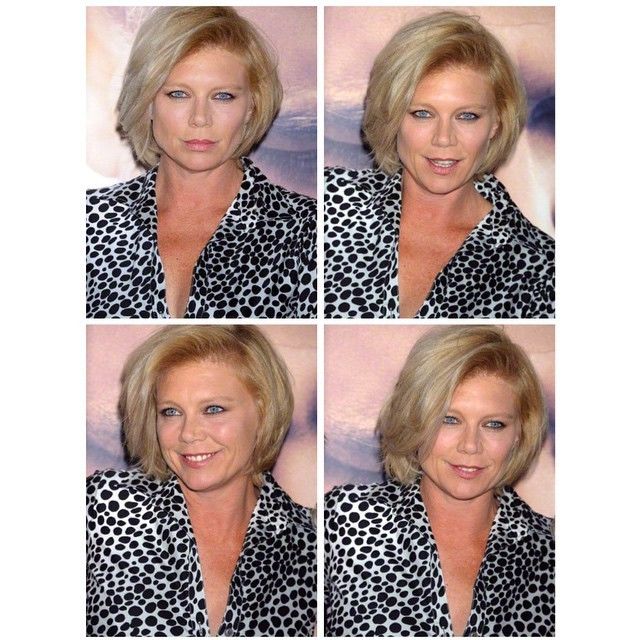 Ini Potret Peta Wilson Sekarang.