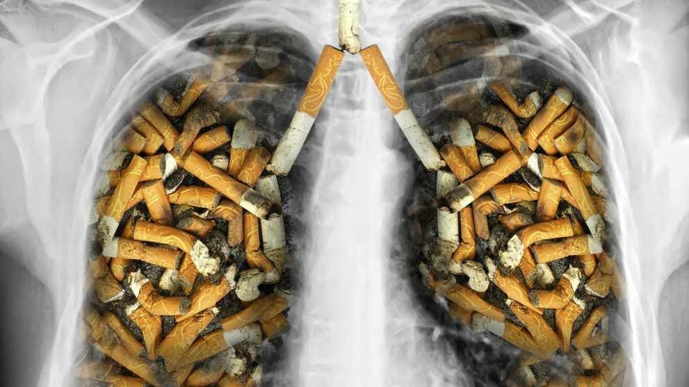 7 Fakta Ngeri Kanker Paru di Indonesia, Benarkah Rokok Pemicunya?
