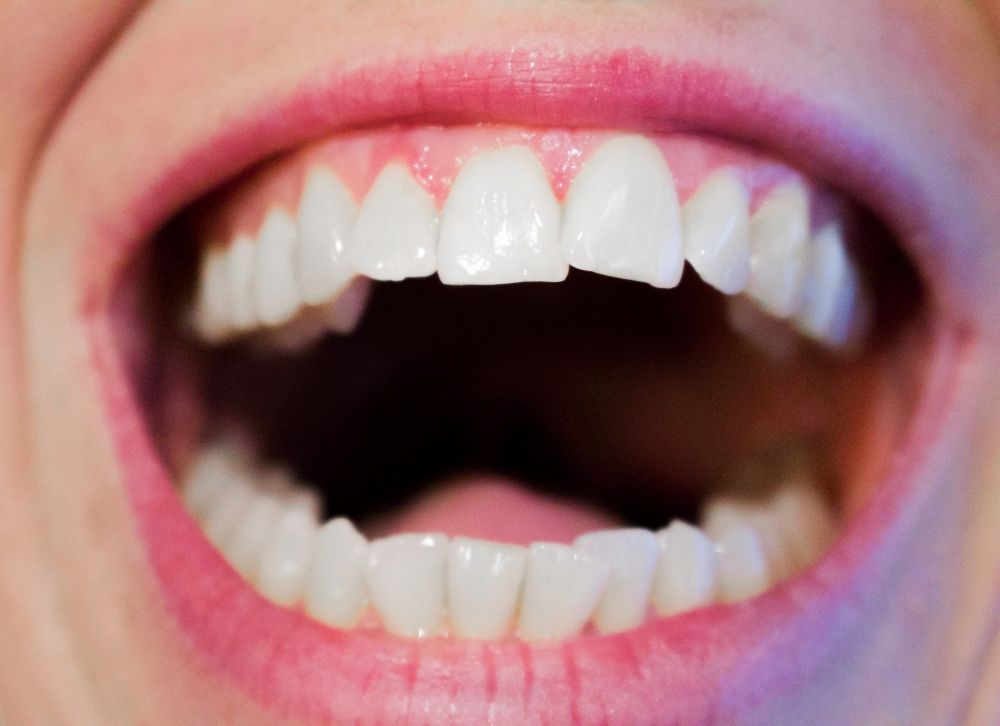 Kenali 19 Fakta Unik Soal Kesehatan Mulut Kamu