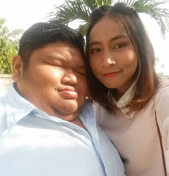 Sempat Viral, 10 Kisah Cinta Tak Pandang Fisik Ini Bisa Jadi Inspirasi