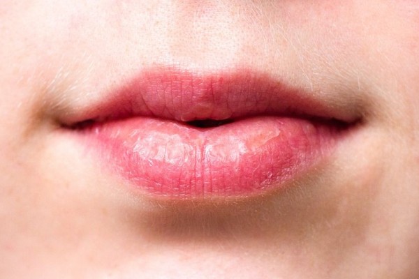 Lakukan 5 Tips Ini Agar Bibir Tidak Kering Saat Berpuasa