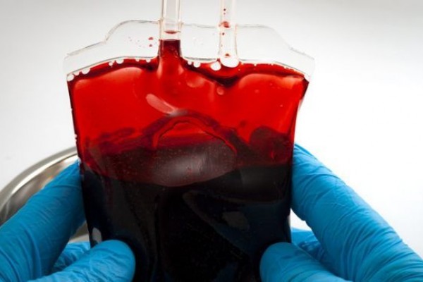 5 Hal yang Perlu Diperhatikan Sebelum Donor Darah