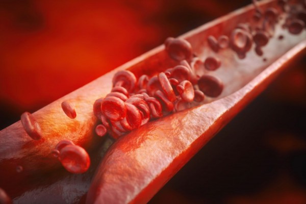 5 Fakta Fitosterol, Bentuk Lain Kolesterol Yang Justru Menyehatkan
