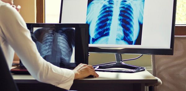 Доклад: Место цифровой рентгенографии в современном алгоритме лучевой диагностики