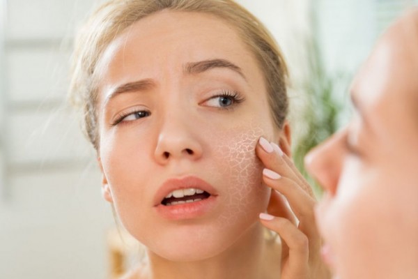 Waspada, 5 Kandungan Skincare Ini Tidak Bersahabat dengan Kulit Kering