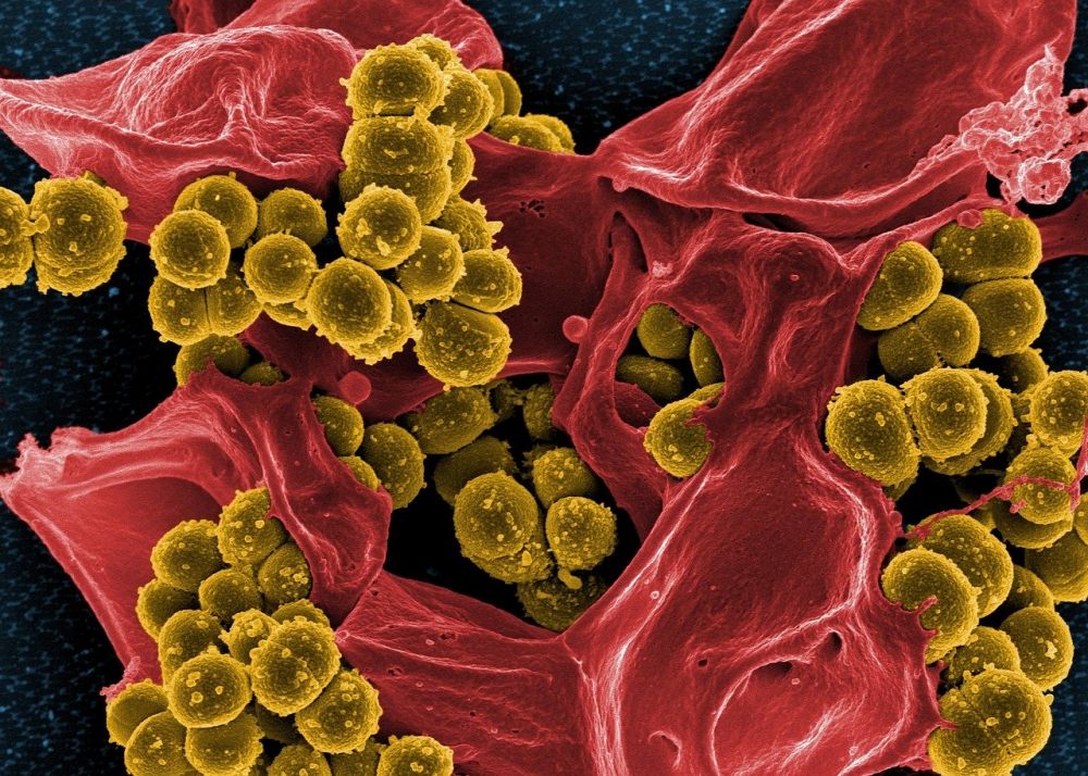 Spesies Baru Bakteri Penghasil Antibiotik Temuan Mahasiswa UGM 