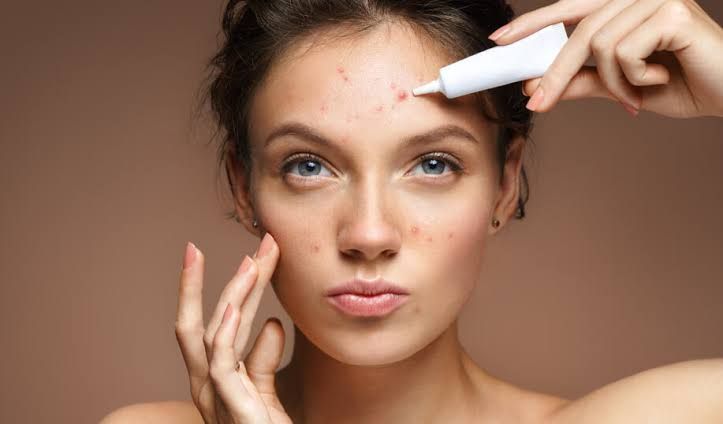 Skincare 101: Jerawat atau Eksim, Gimana Cara Membedakannya?