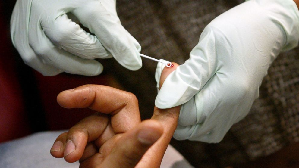 Ada 855 Penyintas, Penularan HIV di Cimahi Kebanyakan Melalui Seks Bebas