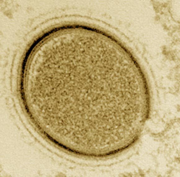 5 Fakta Pithovirus sibericum, Virus Purba yang Kini Hidup Kembali