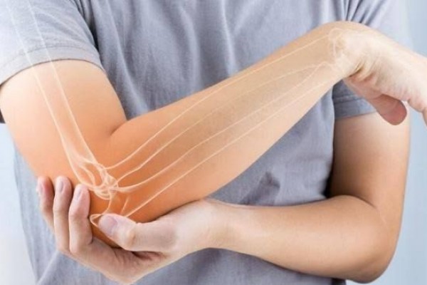 Tennis Elbow: Ketika Sikumu Sering Terasa Nyeri dan Kaku