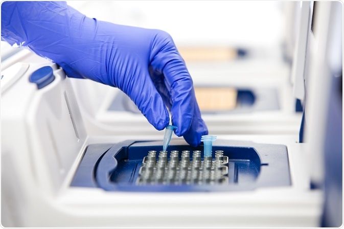 Sumsel Dapat PCR Baru, Satu Hari Bisa Uji 40 Sampel Pasien