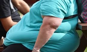 Tabanan Catat 8138 Kasus Obesitas Dialami Anak hingga Dewasa