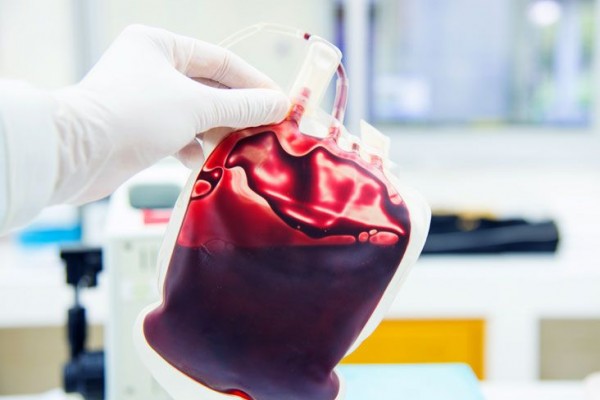 Ada Jutaan Jenis, Ini 6 Fakta Unik Darah yang Gak Banyak Diketahui 