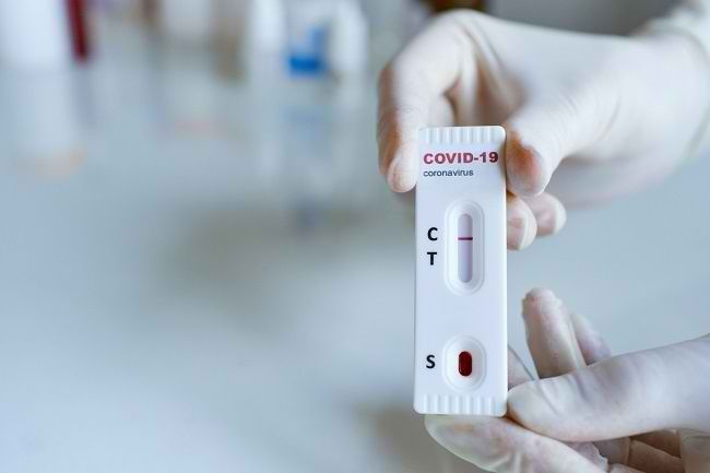 Pakar Virologi Unud Tegaskan Tidak Perlu Rapid Test, PCR Lebih Akurat