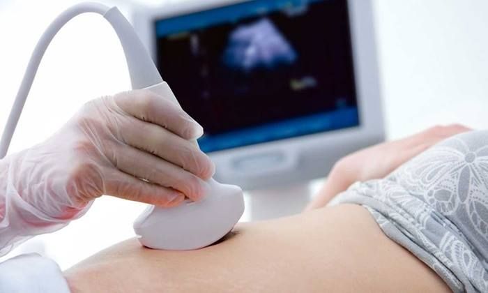 Klinik Kasih Ibu Bajera Tabanan Melayani USG 4 Dimensi