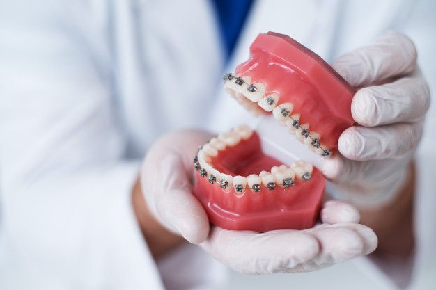 Pentingkah Menggunakan Behel? Ini Kata Dokter Spesialis Ortodonti UGM