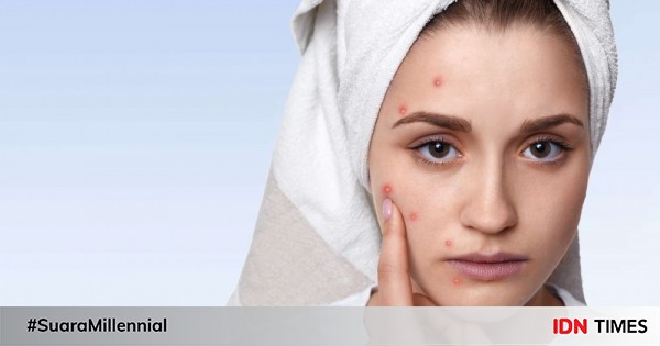 10 Skincare Acne Prone Untuk Kulit Kamu Yang Mudah Berjerawat