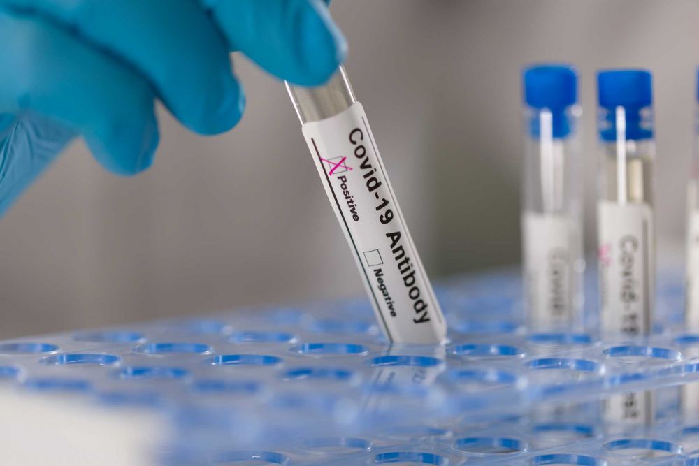 Positive Rate Tinggi, Kota Semarang Diklaim Bisa Tes PCR 8.000 Perbulan