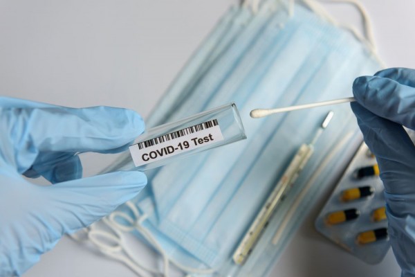 Pemkab Tangerang Dapat Tambahan 50.000 Alat PCR Test dari Kemenkes
