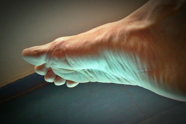5 Tips Merawat Kulit Telapak Kaki agar Tidak Kering dan Mengelupas