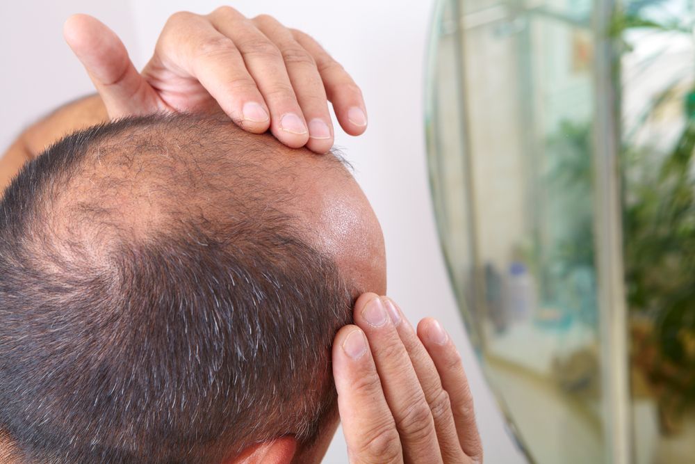 Mengenal Alopecia Penyebab Kebotakan Rambut Jada Pinkett Smith 