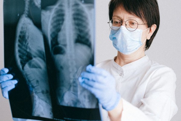 Kisah Pasien Hipertensi Paru, Harus Rutin Berobat Seumur Hidup