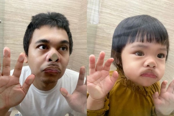 Resmi Jadi Kakak, 9 Potret Kedekatan Alea dan Raditya Dika