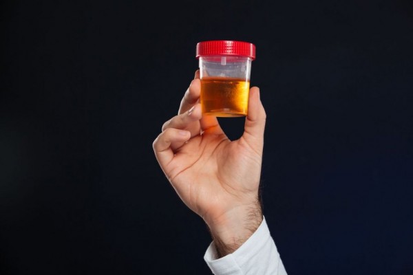 5 Mitos Urine yang Harus Diabaikan, Gak Terbukti secara Medis