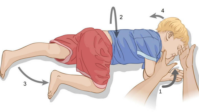 Safe position. Febrile seizure. Epilepsy treatment. Recovery position.