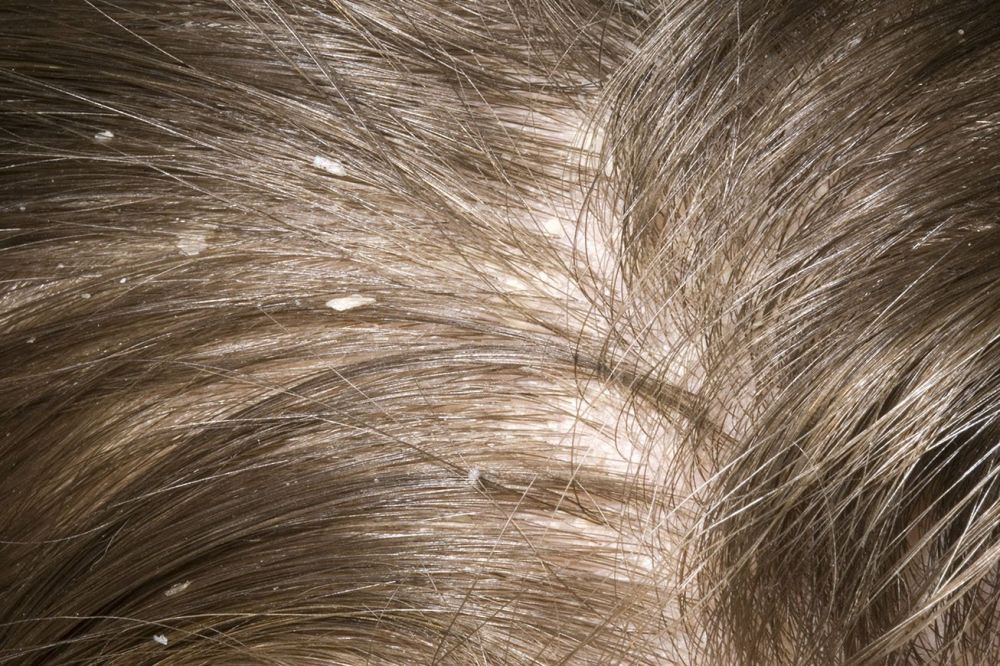 Multifungsi, 7 Manfaat Lidah Buaya untuk Perawatan Kulit dan Rambut 