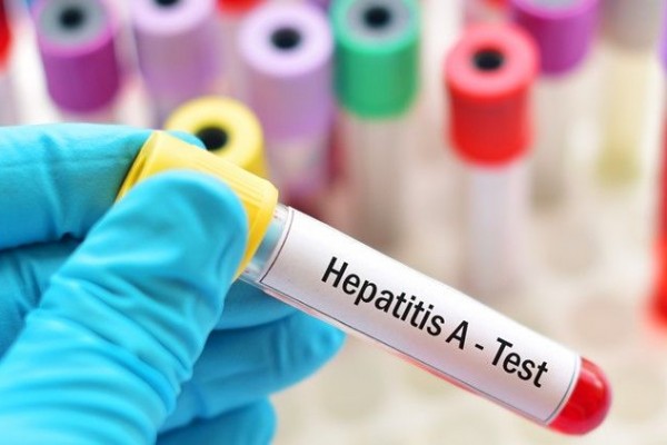 Bocah 8 Tahun di Samarinda Meninggal, Diduga karena Hepatitis Akut