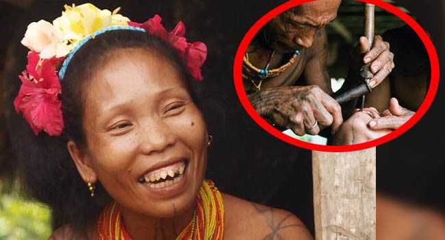 5 Fakta Gigi Runcing, Simbol Kecantikan Perempuan dari Suku Mentawai
