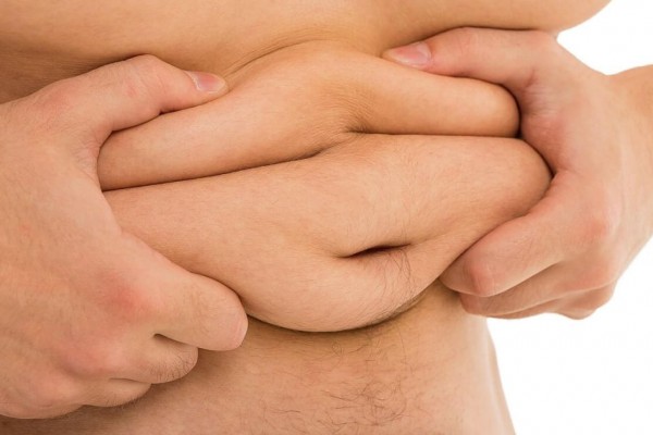 Ternyata Obesitas Tidak Pasti karena Konsumsi MSG