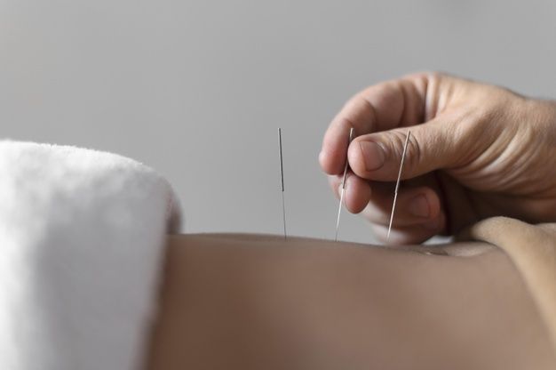 Episode Migrain Saat Menstruasi, Fakta Menstrual Migraine