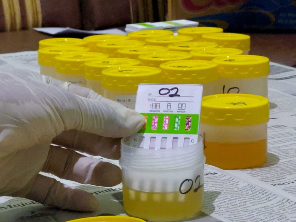 Disidak Propam, Tes Urine Seorang Polisi di Makassar Positif Narkoba
