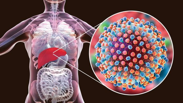Cegah Hepatitis Akut, Dinkes Jateng Ungkap 7 Ciri-ciri yang Patut Diwaspadai