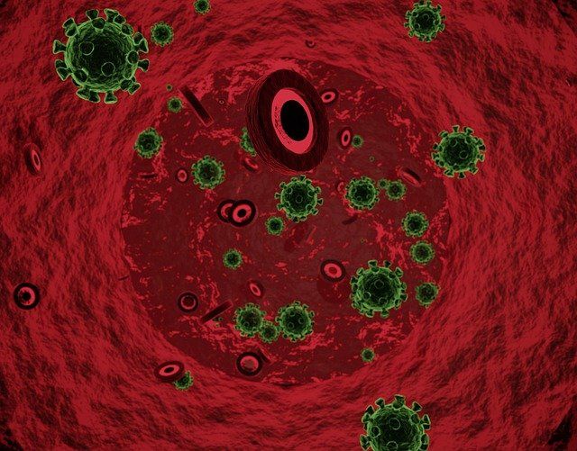 5 Jenis Infeksi Jamur yang Umum Menyerang Pasien HIV