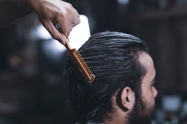 Ketahuilah 5 Gejala Rambut Rontok pada Pria