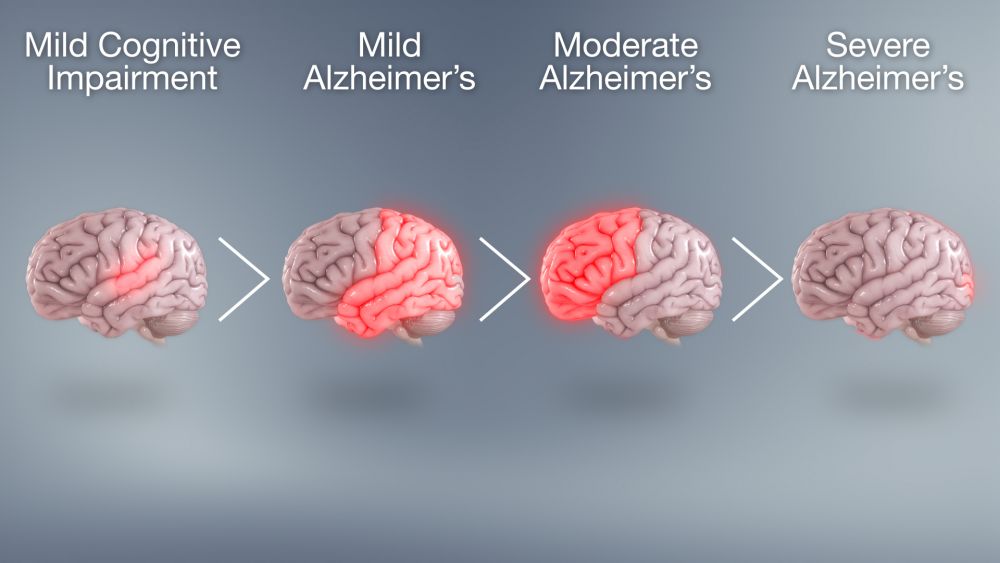 289 Lansia di Jateng Alzheimer: Pengaruh Hedonisme, Mementingkan Uang