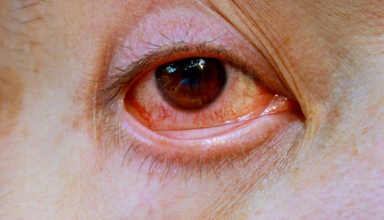 Bahaya Gadget Bagi Mata dan Cara Pencegahan dari Penyakit